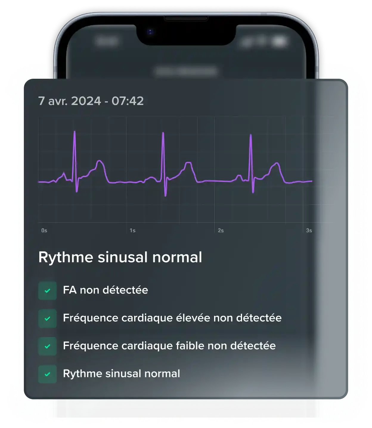Lecteur cardiaque WHOOP — rapport ECG rythme sinusal